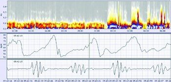 Schiller medilog Holter Floating Network License