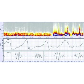 Schiller medilog Holter Floating Network License