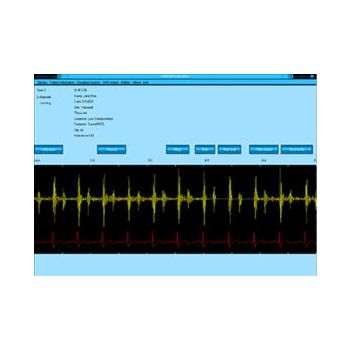 StethView Digital Recording System,717-8000